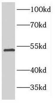 FSCN1 Rabbit Polyclonal Antibody