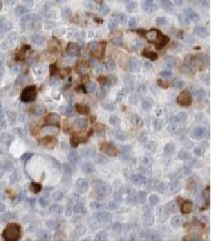 FSCN1 Rabbit Polyclonal Antibody