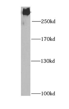 FASN Rabbit Polyclonal Antibody