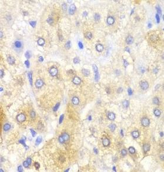 FASN Rabbit Polyclonal Antibody