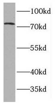 FASTKD2 Rabbit Polyclonal Antibody