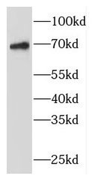FBF1 Rabbit Polyclonal Antibody