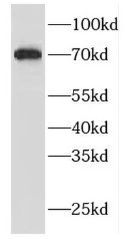 FBF1 Rabbit Polyclonal Antibody