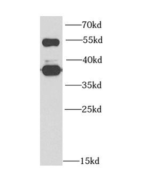 FBL Rabbit Polyclonal Antibody