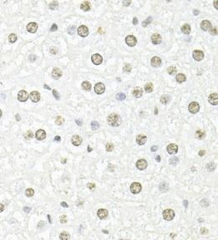 FBL Rabbit Polyclonal Antibody