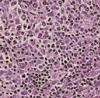 FBXL18 Rabbit Polyclonal Antibody