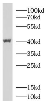 FBXO32 Rabbit Polyclonal Antibody