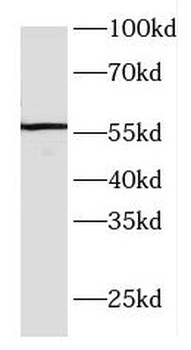 FBXO5 Rabbit Polyclonal Antibody