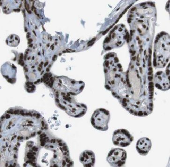 FBXO5 Rabbit Polyclonal Antibody