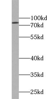 FBXW7 Rabbit Polyclonal Antibody