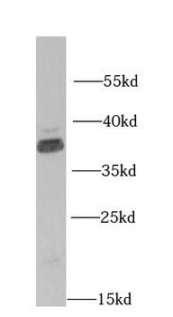 FCN1 Rabbit Polyclonal Antibody