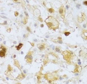 FCN1 Rabbit Polyclonal Antibody