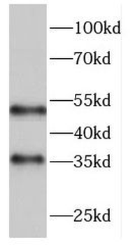 FCN3 Rabbit Polyclonal Antibody