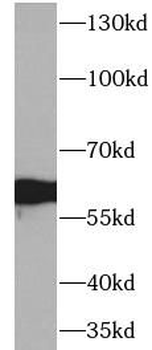 AHSG Rabbit Polyclonal Antibody