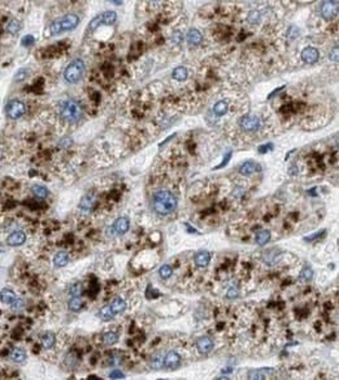 AHSG Rabbit Polyclonal Antibody