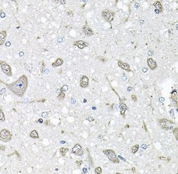 FGF1 Rabbit Polyclonal Antibody