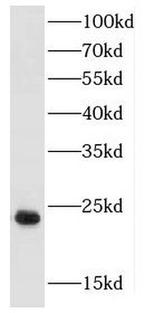 FGF12 Rabbit Polyclonal Antibody