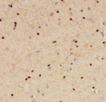 FGF12 Rabbit Polyclonal Antibody