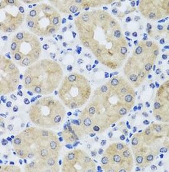 FGF13 Rabbit Polyclonal Antibody