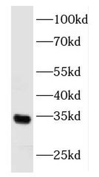 FGF17 Rabbit Polyclonal Antibody