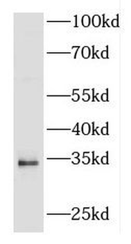 FGF5 Rabbit Polyclonal Antibody