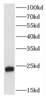 FGF8 Rabbit Polyclonal Antibody