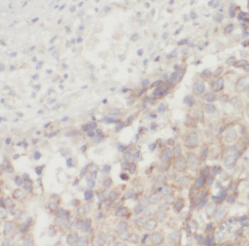 FGF8 Rabbit Polyclonal Antibody
