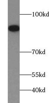 FGFR1 Mouse Monoclonal Antibody