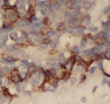 FGFR1 Mouse Monoclonal Antibody
