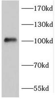 FGFR4 Rabbit Polyclonal Antibody
