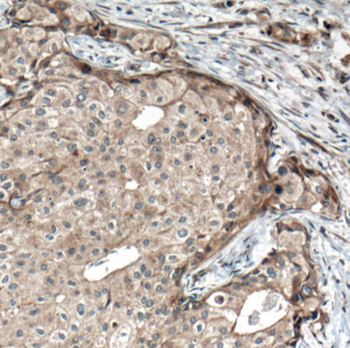 FGFR4 Rabbit Polyclonal Antibody