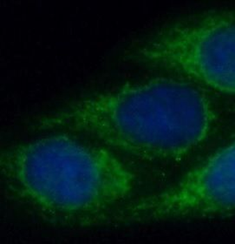 FGL2 Rabbit Polyclonal Antibody