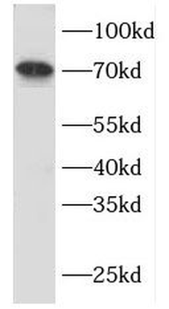 FGL2 Rabbit Polyclonal Antibody