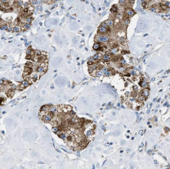 FGL2 Rabbit Polyclonal Antibody