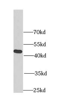 FIBP Rabbit Polyclonal Antibody
