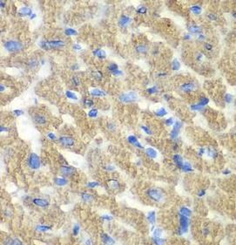 FIBP Rabbit Polyclonal Antibody