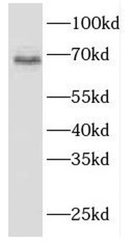 FBLN5 Rabbit Polyclonal Antibody