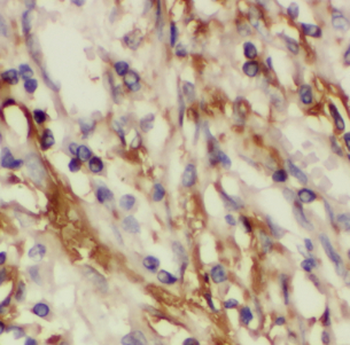 FBLN5 Rabbit Polyclonal Antibody