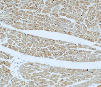 FBLN5 Mouse Monoclonal Antibody