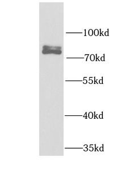 FIP1L1 Rabbit Polyclonal Antibody