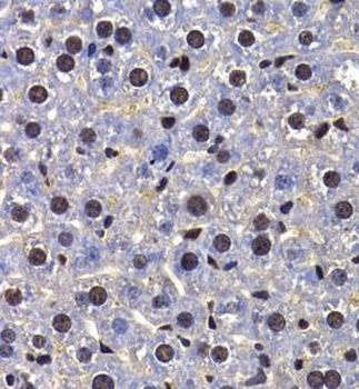 FIP1L1 Rabbit Polyclonal Antibody