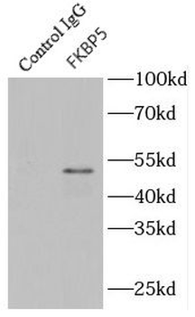 FKBP5 Rabbit Polyclonal Antibody