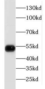 FKBP5 Rabbit Polyclonal Antibody