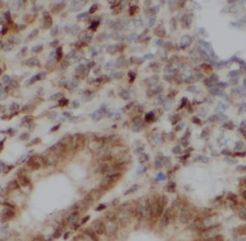 FKBP5 Rabbit Polyclonal Antibody