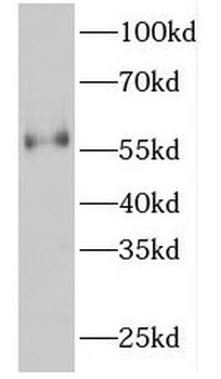 FKBP4 Rabbit Polyclonal Antibody