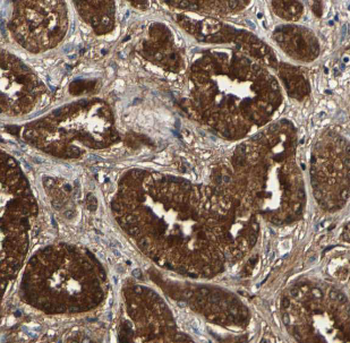 FKBP4 Rabbit Polyclonal Antibody