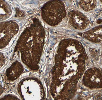 FKBP4 Rabbit Polyclonal Antibody