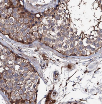 FKBPL Rabbit Polyclonal Antibody