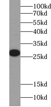 Flag tag Mouse Monoclonal Antibody