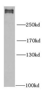FLNB Rabbit Polyclonal Antibody